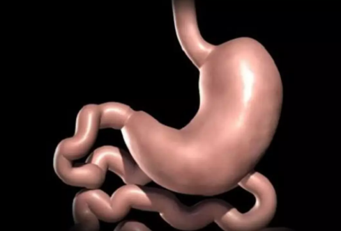 Screen-Shot-2019-09-06-at-09.20.45 sleeve gastrectomy