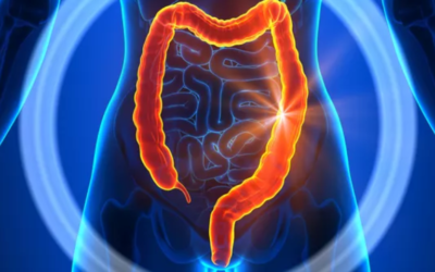 Rectocolite hémorragique : Symptômes, causes & solutions