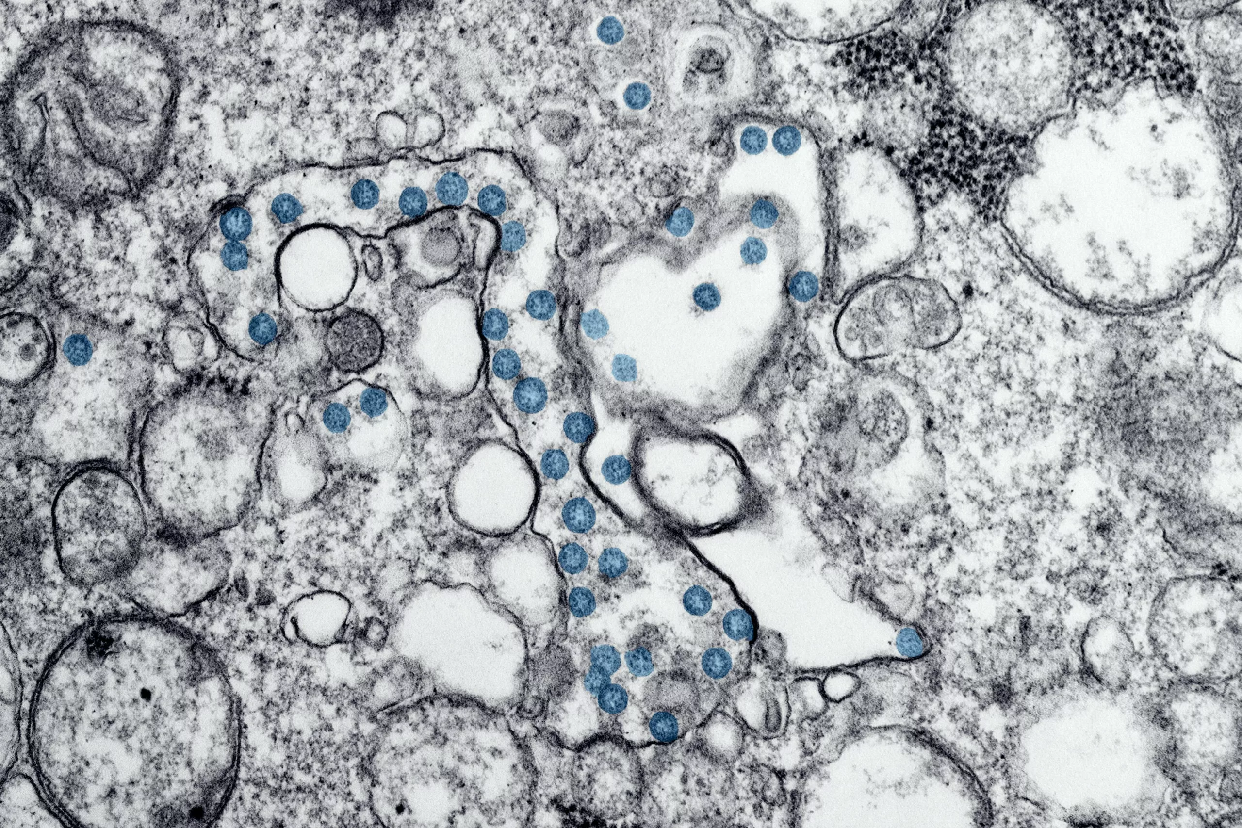 Comment Équilibrer Son Microbiote Intestinal pour Améliorer la Santé et l'Humeur