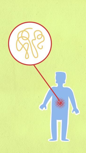 Qu'est-ce que la perméabilité intestinale ? – consultation nutritionniste